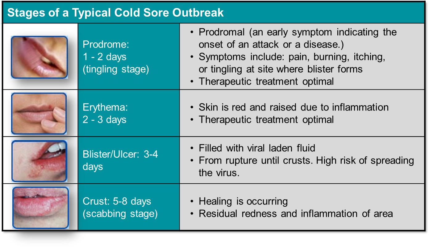 CSPA - Symptoms